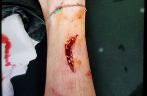 As “marcas da guerra” no jogo da II Liga