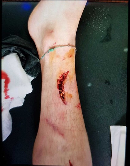 As “marcas da guerra” no jogo da II Liga