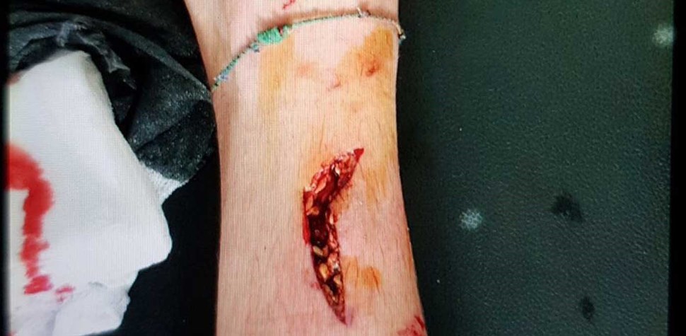 As "marcas da guerra" no jogo da II Liga