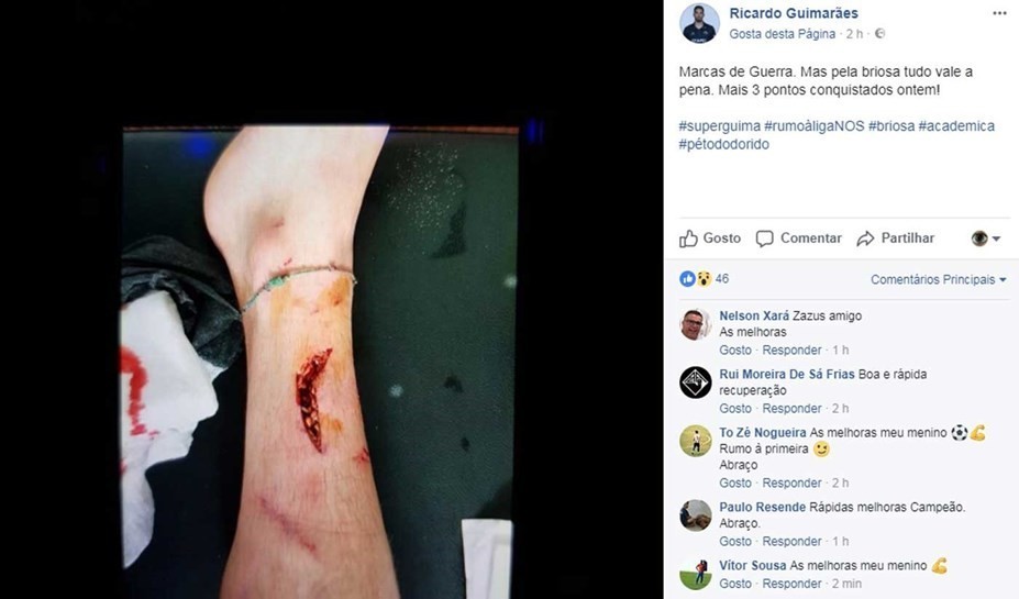 As "marcas da guerra" no jogo da II Liga